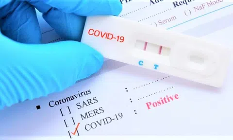 Bộ Lc888.com link không chặn: Cần đánh giá kỹ trước khi đưa sản phẩm test nhanh COVID-19 vào diện bình ổn giá
